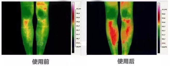 穿衣小技巧冬天这样穿很显腿长,冬天穿什么腿不冷还轻松不显臃肿