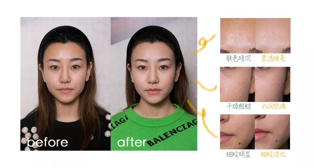 买正品的面膜,新型的抗皱面膜