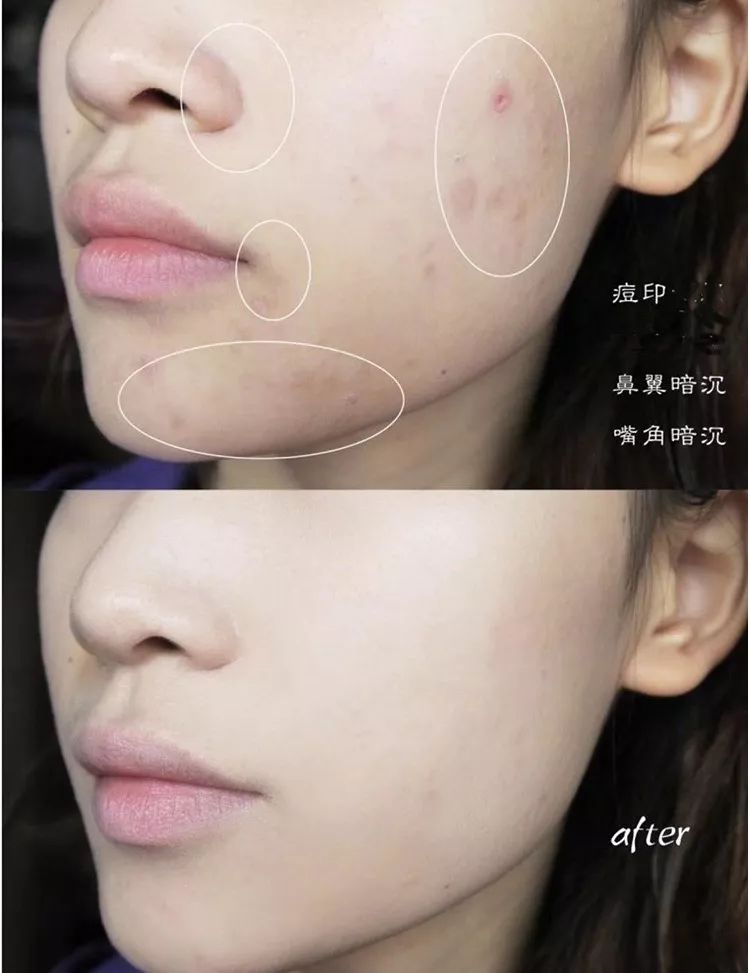 卡粉起皮用面霜还是乳液,卡粉起皮救星底妆难题解决