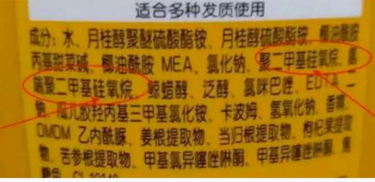 头皮痒头屑多有头螨怎么办,头螨大块头屑怎么治好得快