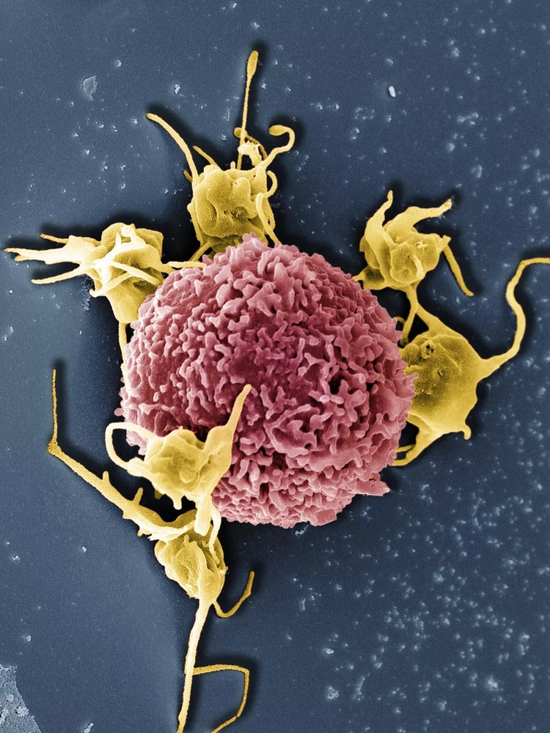 鍋囧鐥呮瘨鎰熸煋浜嗕綘,鍋囧鐥呮瘨鎰熸煋浜嗘垜