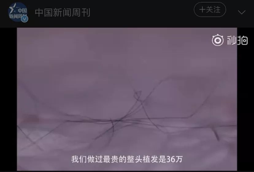 防脱发的生姜洗发水安利,官方推荐防脱洗发水