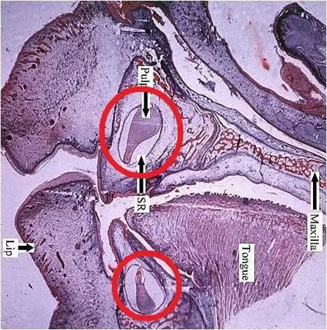 牙齿离奇失踪,牙齿诡异事件