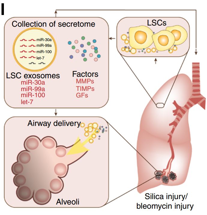 目前公认有效的抗肺纤维化,治疗肺纤维化秘方
