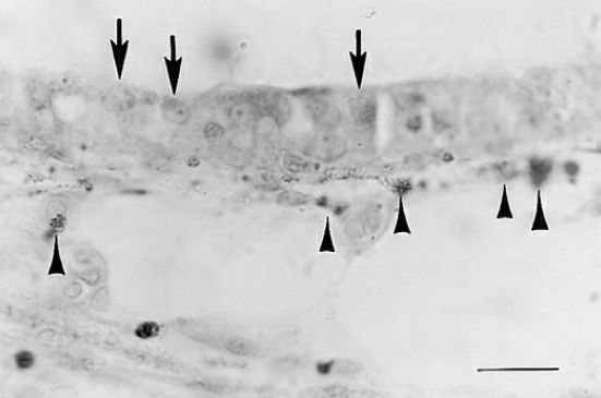 22张图，细说梅尼埃病的组织病理学特点丨“晕”筹帷幄