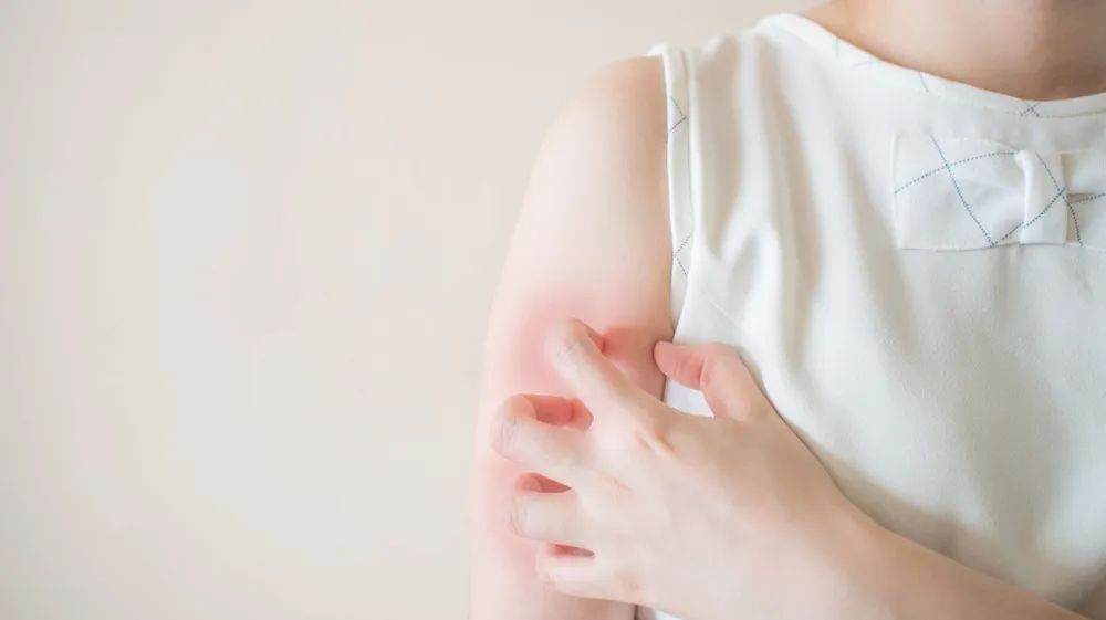 宝宝湿疹反复发作怎么断根,湿疹反复发作会引起癌变吗