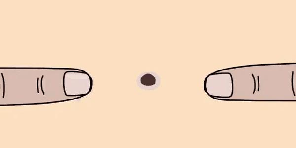 黑头痘印怎么去除,黑头痘印怎么消除学生党