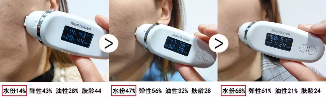 珊苏丽祛痘洁面皂,姗苏丽果酸洁面皂