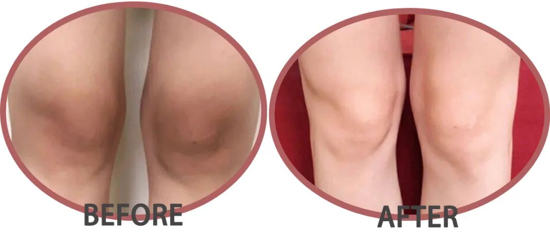 无痛搓泥|日系变态搓澡巾！轻轻搓一搓，泥条劈里啪啦的掉