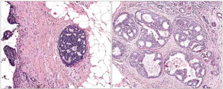 临床试验获nmpa批准,ai显微镜能识别癌细胞吗