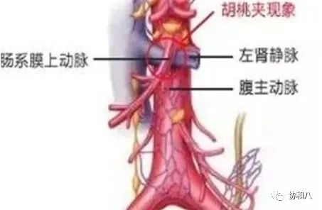 复习这些名解时总觉得怪饿的|协和八·脑洞大开