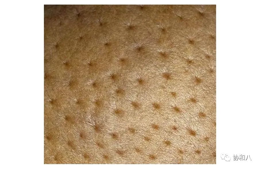 复习这些名解时总觉得怪饿的|协和八·脑洞大开