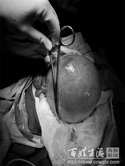 患者腹疼难忍,腹如刀绞是什么感觉