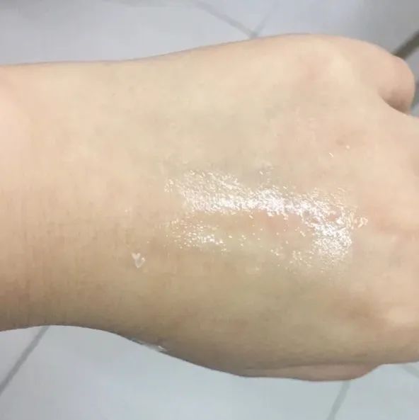 100个皮肤问题案例,世界上十大皮肤顽疾