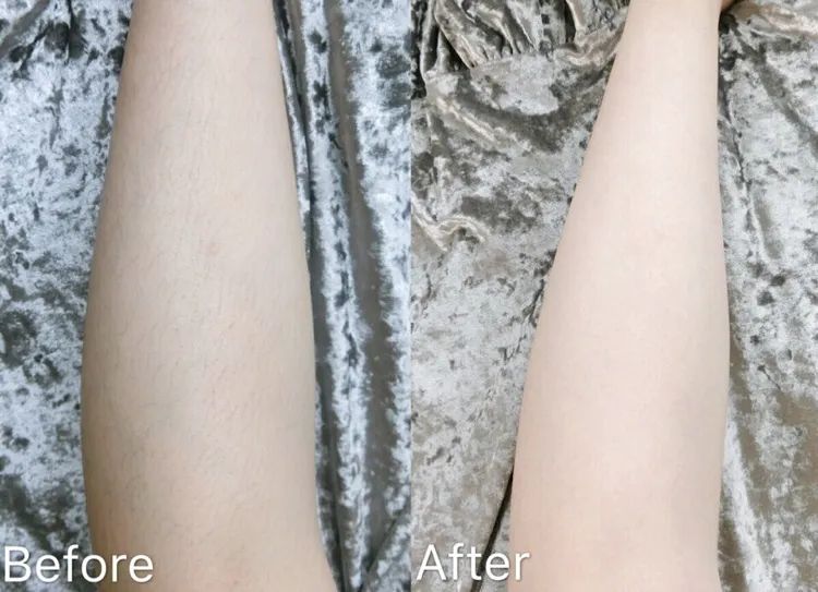 光滑无暇|黑丑的“毛裤腿”，用它，10分钟“脱”得一干二净，肌肤光滑细腻