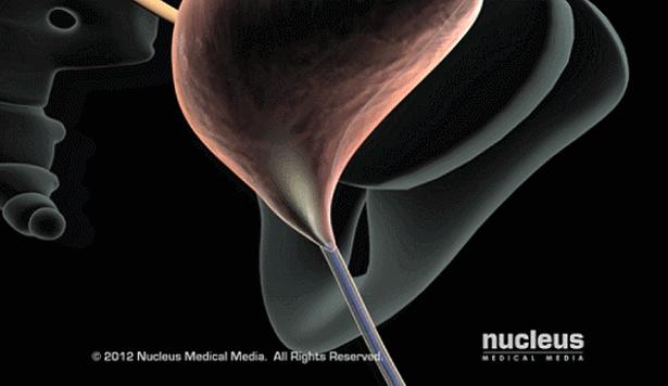 盘点医院各大科室侵入性检查：穿刺、内镜各显神通，小活检标本以“小”见“大”