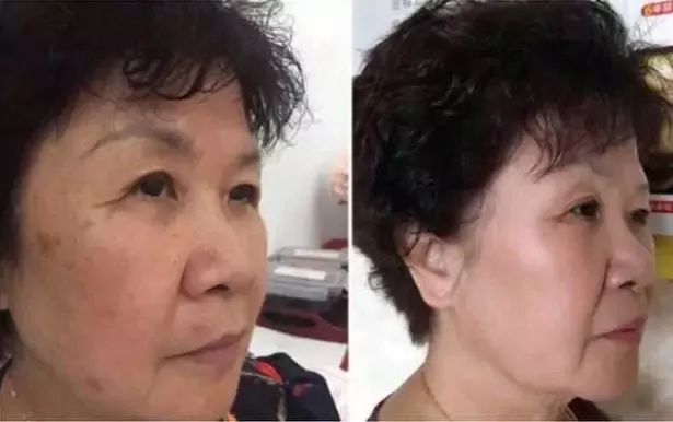 长期补充胶原蛋白的人怎么样了,长期喝胶原蛋白的人最后怎么样了