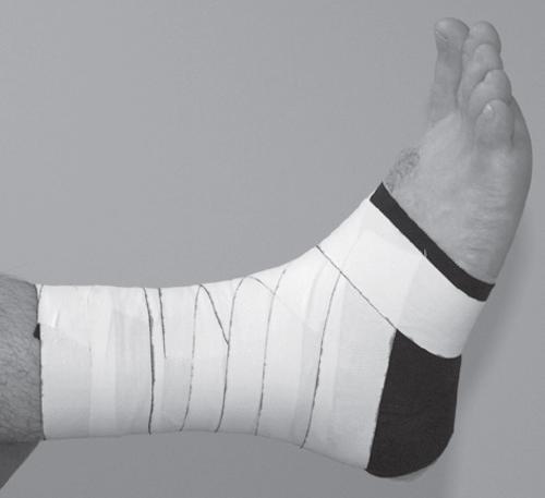 瓒崇悆杩愬姩鍛樺彈浼ゅ湪鍖婚櫌娌荤枟,瓒崇悆鐞冨憳鍙椾激瀵规墜鎻愰啋