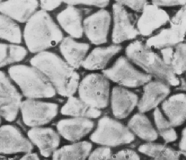 桑蚕丝夏凉被薄款,桑蚕丝被是否冬暖夏凉