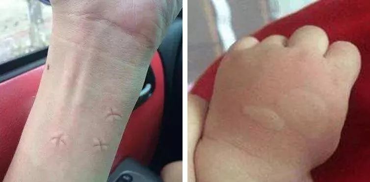 日本环保驱蚊剂,健康驱蚊神器