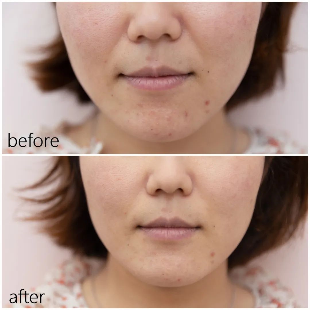 推广｜|不到50块就能享受女明星同款豪华SPA，一次就惊艳