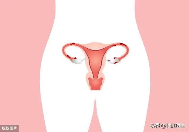 b超检查子宫内膜回声不均,b超检查显示子宫回声不均