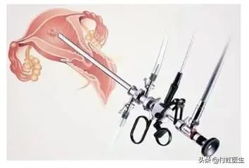 b超检查子宫内膜回声不均,b超检查显示子宫回声不均