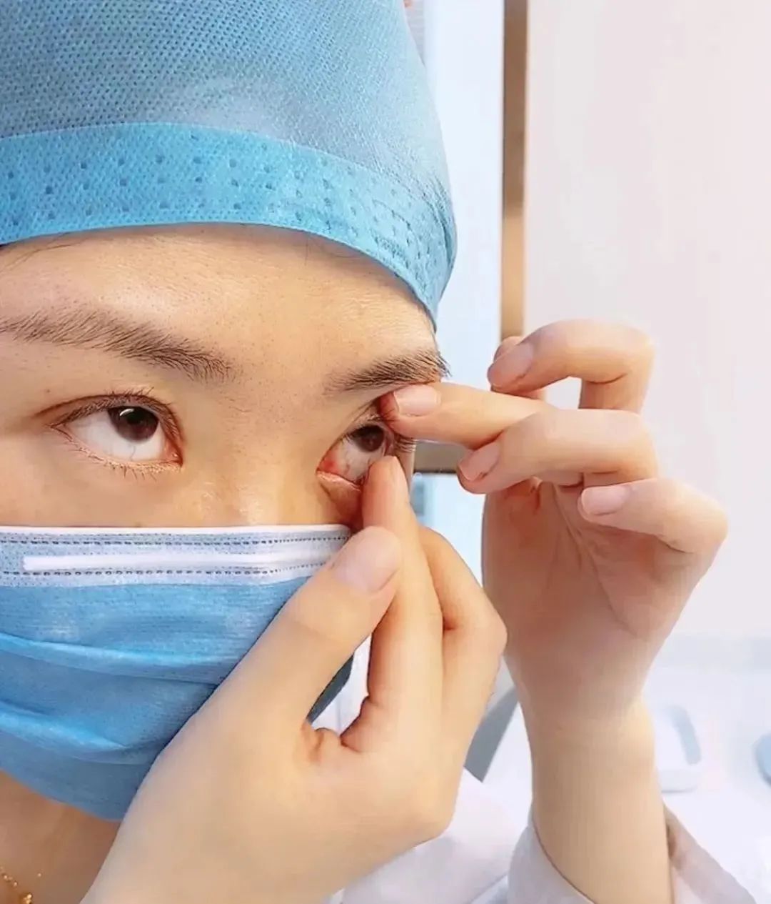 隐形眼镜可以徒手摘吗,摘隐形眼镜有什么好方法吗