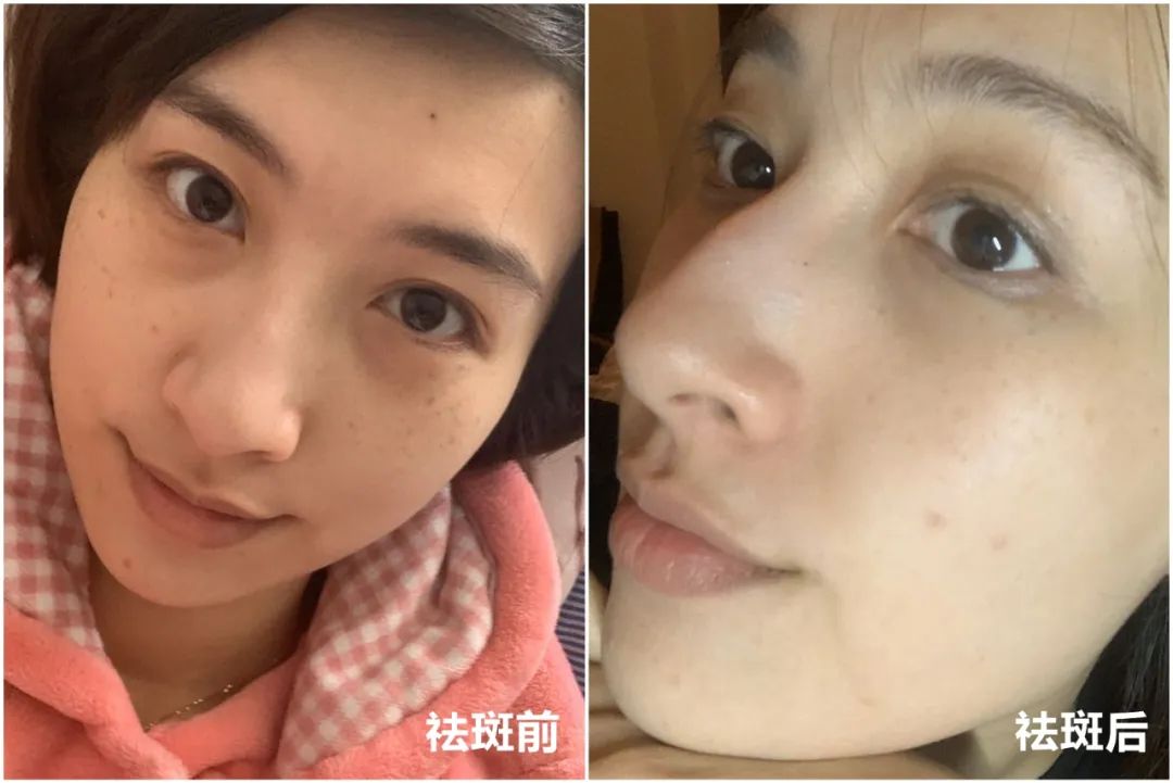 做完医美真的能换脸吗,做完医美需要注意什么