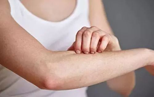 炎炎夏日，德州市中医院皮肤科提醒：谨防皮肤病成“颜值杀手”