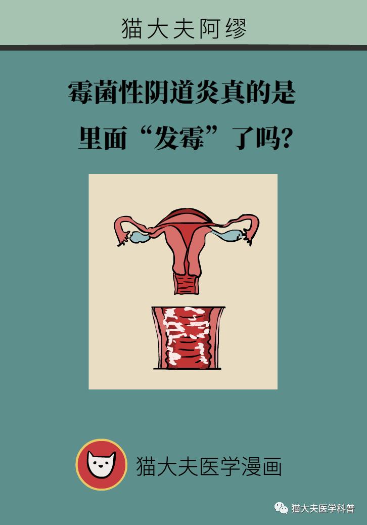 霉菌性阴道炎真的是里面“发霉”了吗？药师教你“抗霉”*法大**