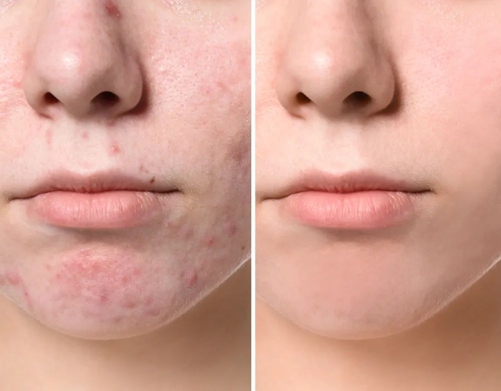 医美面膜真的好用吗,被我们夸上天的护肤品