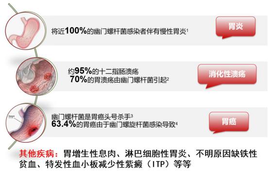 北平说|幽门螺旋杆菌反复杀不死？精准诊疗帮你忙！