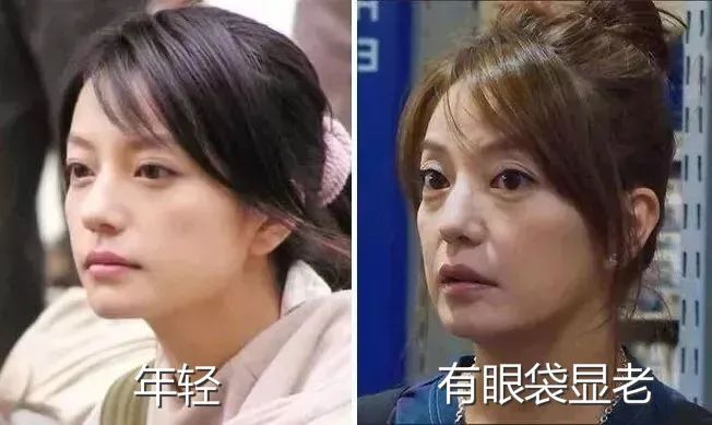 国货眼霜马应龙八宝,马应龙去黑眼霜官方旗舰店