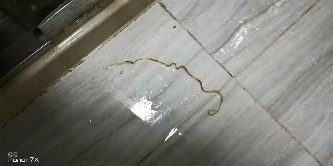 一只寄生虫,寄生虫需要去疾控中心检查吗