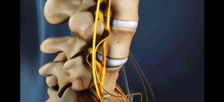 腰痛的真正原因是什么,腰痛要警惕五种原因