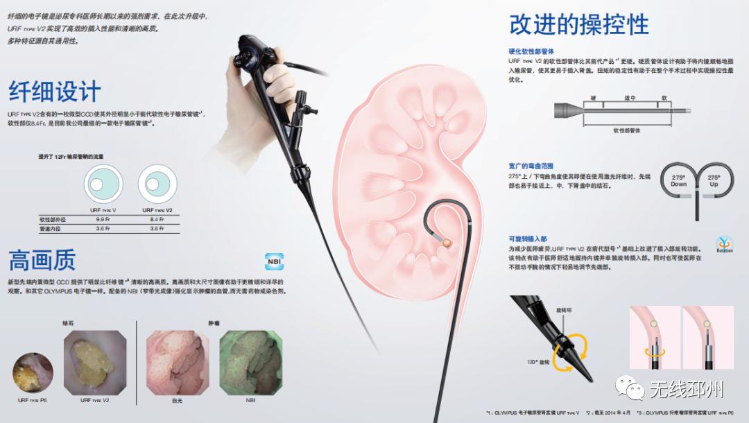 省人民医院泌尿外科治肾结石,江苏省中医医院泌尿系结石专家