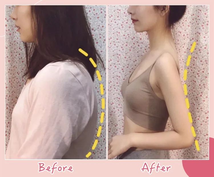 驼背平时自己注意可以改善吗,驼背如何矫正自己的气质