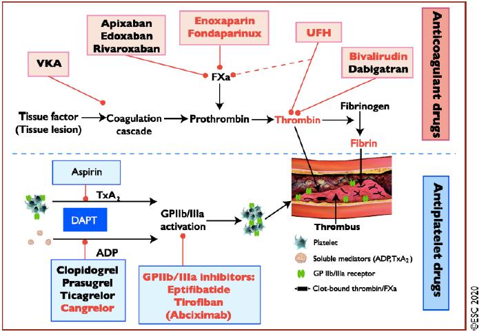 非st段抬高型心梗的治疗,非st抬高型心梗诊断标准