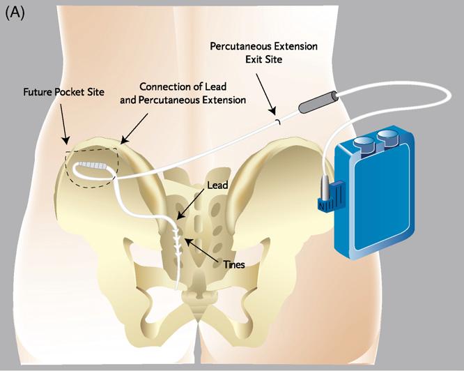 痛如刀绞、生不如死…疼痛部位难以启齿，6年没看好的痛最终在这里得救