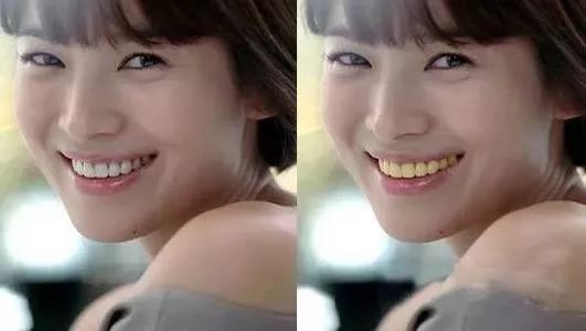 牙粉去烟渍牙结石牙膏排名第一名,美白牙膏推荐去牙黄老牌子