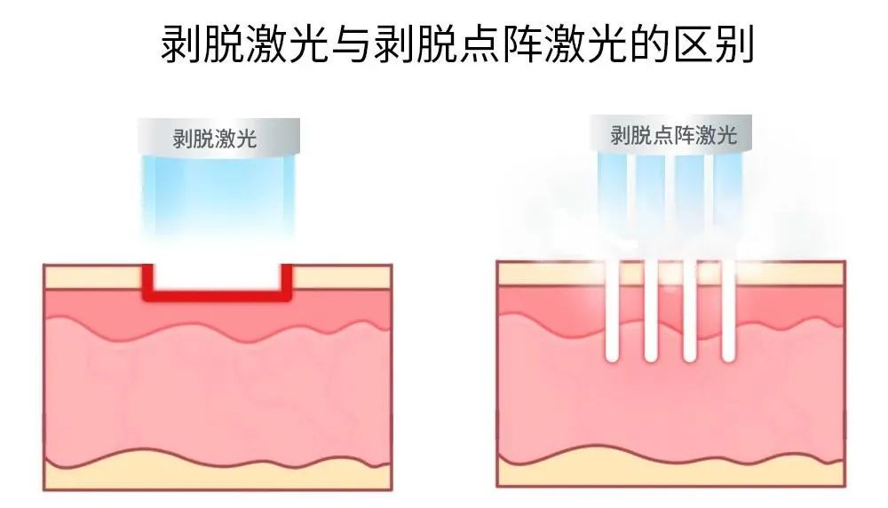 痘痘不再反复了怎么办,痘痘不消失怎么办