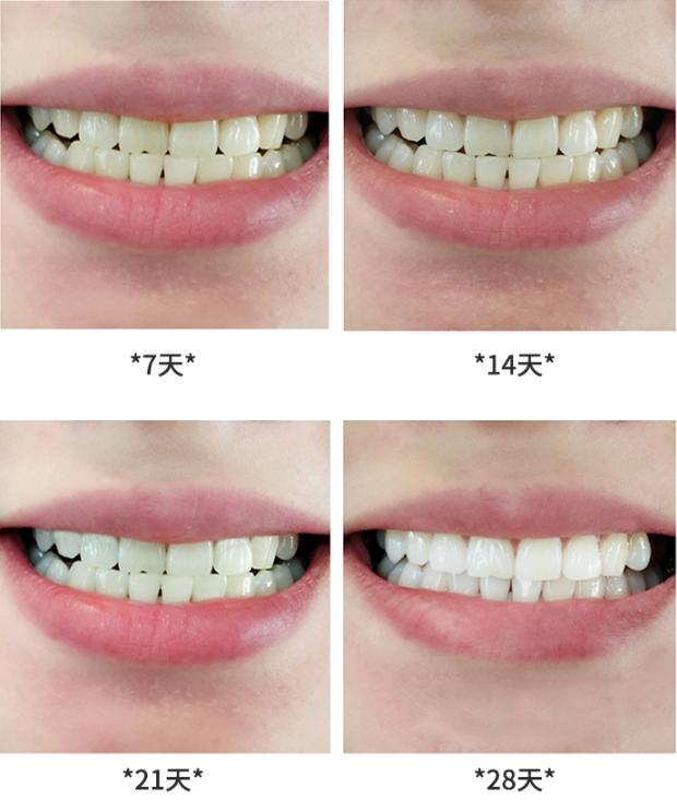 瑞士国民牙膏治牙敏感,牙齿酸用抗敏感牙膏有效