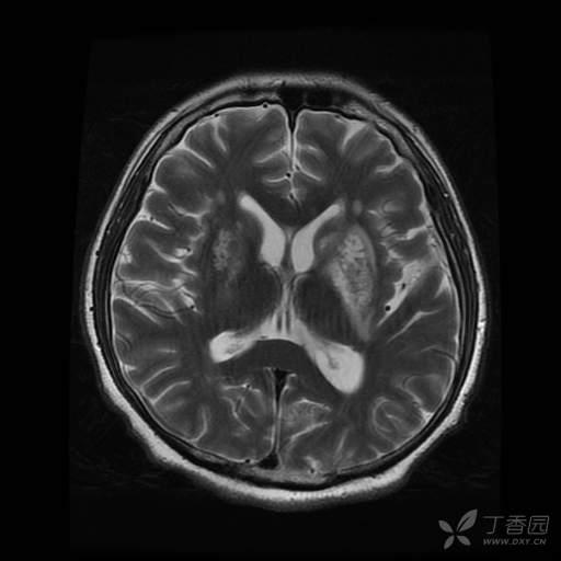 24岁小伙喝下安眠药后续,小伙吃安眠药睡觉