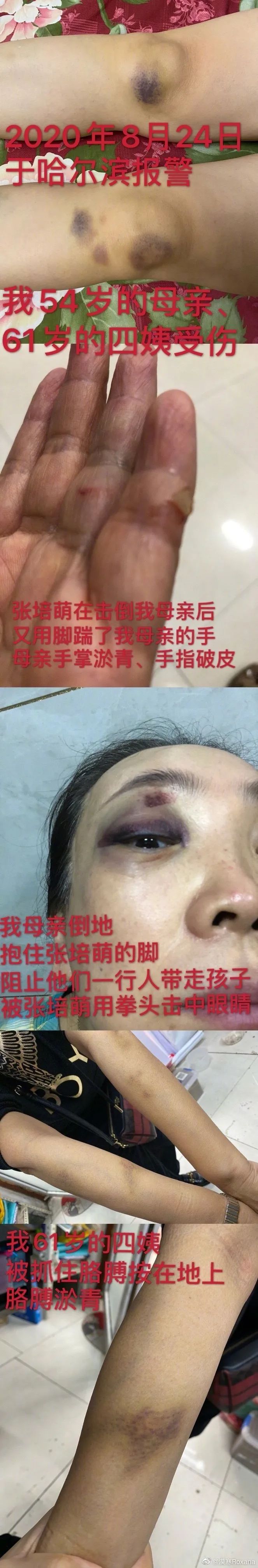 男运动员被家暴,运动员被家暴