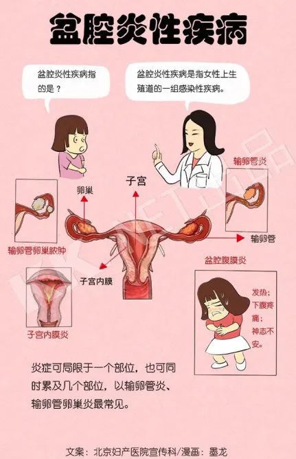 了解盆腔炎，预防盆腔炎