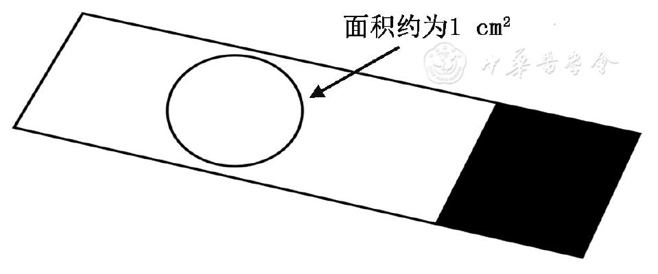 icu患者肺栓塞应急预案演练脚本,肺泡灌洗液标本标准