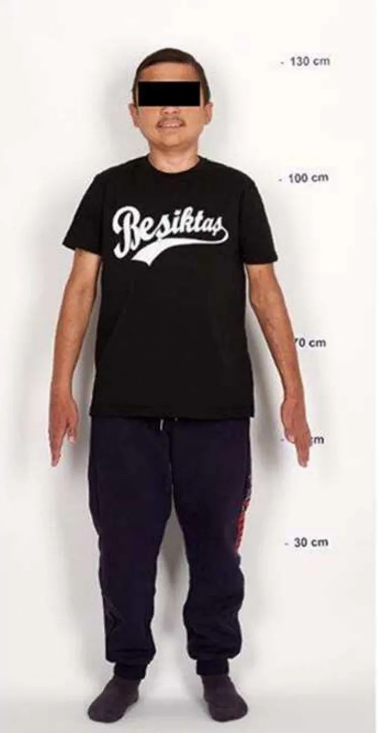 lr858基因突变,lrba基因