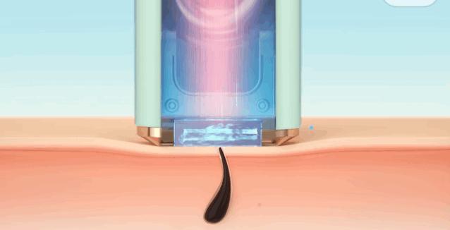 腿粗暗沉粗糙？为什么教程也救不了你的颜值bug？