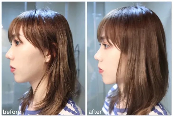 火遍全网的生发养发防脱固发,去屑止痒防脱养发